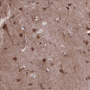 Anti-AKAP5 antibody produced in rabbit 