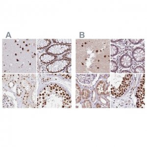 Anti-AKAP8L antibody produced in rabbit 
