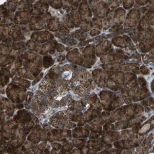 Anti-AKR1A1 antibody produced in rabbit 