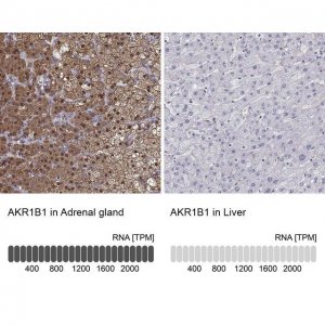 Anti-AKR1B1 antibody produced in rabbit 