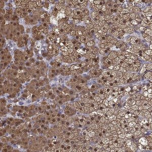 Anti-AKR1B1 antibody produced in rabbit 