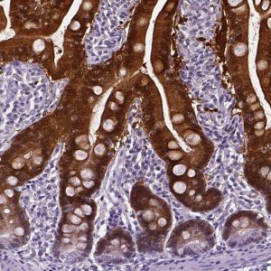 Anti-AKR1B10 antibody produced in rabbit 