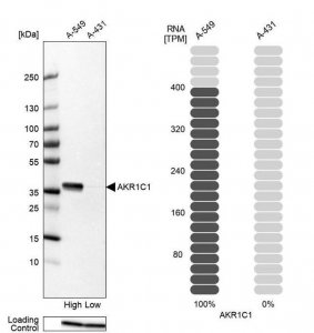 Anti-AKR1C1 antibody produced in rabbit HPA068265-100UL