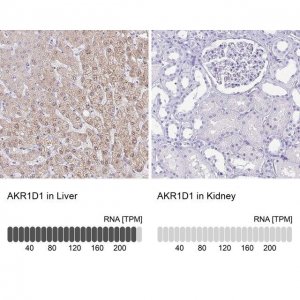 Anti-AKR1D1 antibody produced in rabbit HPA057002-100UL