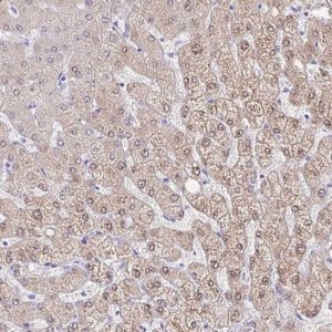 Anti-AKR1D1 antibody produced in rabbit HPA057002-100UL