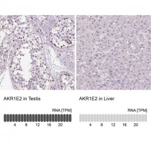 Anti-AKR1E2 antibody produced in rabbit 