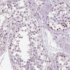 Anti-AKR1E2 antibody produced in rabbit 