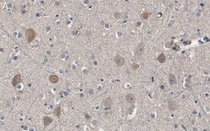 Anti-Akt Antibody, PH Domain Antibody, clone SKB1 ZooMAb Mouse Monoclonal 