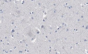 Anti-Akt Antibody, PH Domain Antibody, clone SKB1 ZooMAb Mouse Monoclonal 