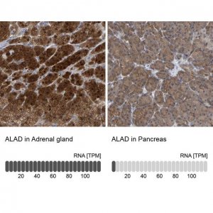 Anti-ALAD antibody produced in rabbit 