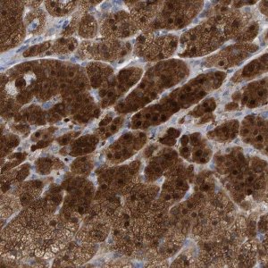 Anti-ALAD antibody produced in rabbit 