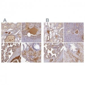 Anti-ALB antibody produced in rabbit 