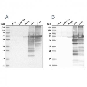 Anti-ALB antibody produced in rabbit 