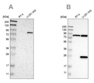 Anti-ALDH18A1 antibody produced in rabbit 