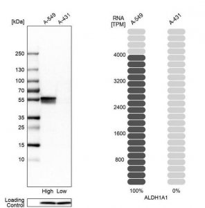 Anti-ALDH1A1 antibody produced in rabbit 