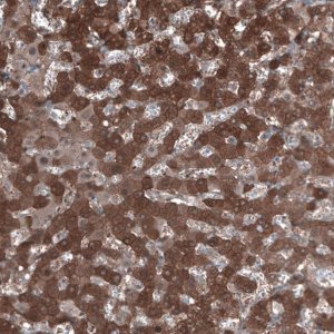 Anti-ALDH1A1 antibody produced in rabbit 