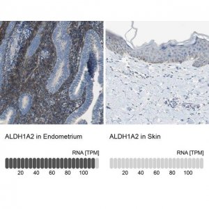 Anti-ALDH1A2 antibody produced in rabbit 