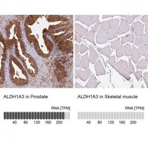 Anti-ALDH1A3 antibody produced in rabbit 