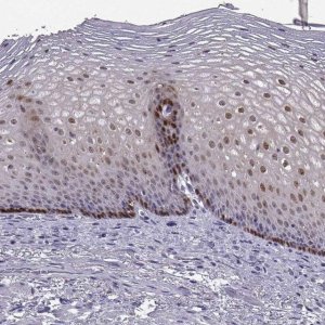 Anti-ALDH3A1 antibody produced in rabbit 