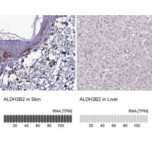 Anti-ALDH3B2 antibody produced in rabbit 