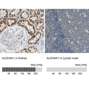 Anti-ALDH4A1 antibody produced in rabbit 