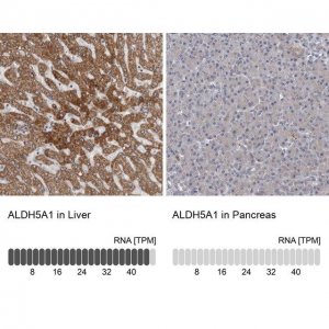 Anti-ALDH5A1 antibody produced in rabbit 