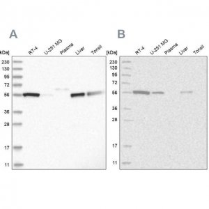Anti-ALDH5A1 antibody produced in rabbit 