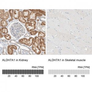 Anti-ALDH7A1 antibody produced in rabbit 