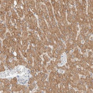 Anti-ALDH7A1 antibody produced in rabbit 