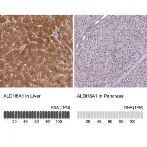 Anti-ALDH8A1 antibody produced in rabbit 