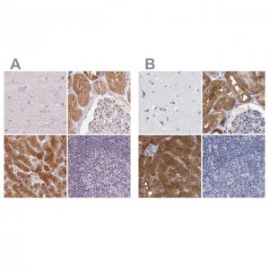 Anti-ALDH8A1 antibody produced in rabbit 