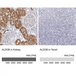 Anti-ALDOB antibody produced in rabbit HPA002198-100UL