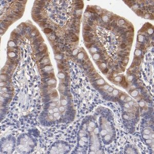 Anti-ALDOB antibody produced in rabbit HPA002198-100UL