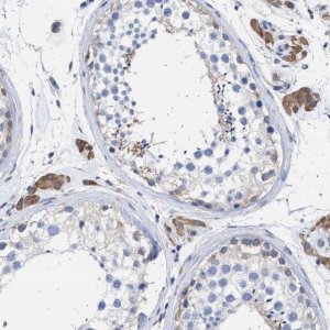 Anti-ALDOC antibody produced in rabbit 