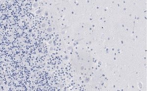 Anti-Aldolase C Antibody, clone 3B18, ZooMAb Rabbit Monoclonal 