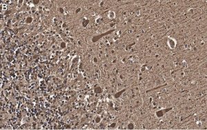 Anti-Aldolase C Antibody, clone 3B18, ZooMAb Rabbit Monoclonal 