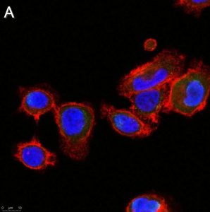 Anti-ALK-7 Antibody, clone 1N5 ZooMAb Rabbit Monoclonal 