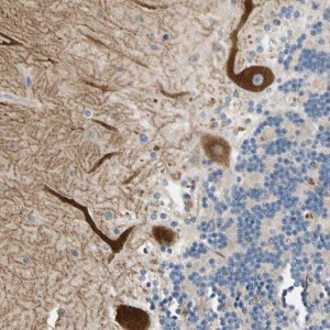 Anti-ALKBH3 antibody produced in rabbit 