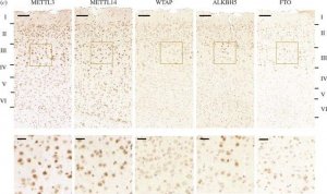 Anti-ALKBH5 antibody produced in rabbit 