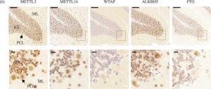 Anti-ALKBH5 antibody produced in rabbit 