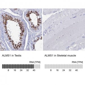 Anti-ALMS1 antibody produced in rabbit 