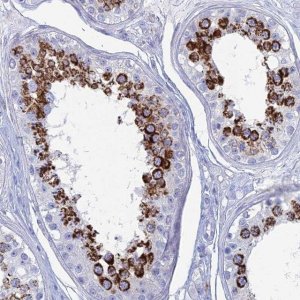 Anti-ALMS1 antibody produced in rabbit 