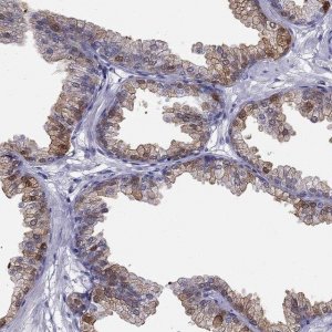 Anti-ALOX15B antibody produced in rabbit 