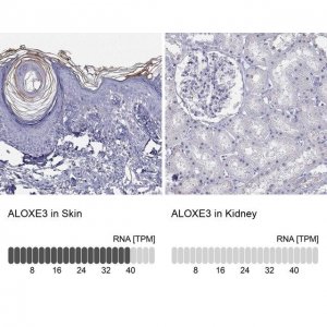 Anti-ALOXE3 