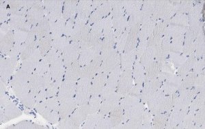 Anti-alpha Actinin 2 Antibody, clone 1E11, ZooMAb Rabbit Monoclonal 