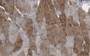 Anti-alpha Actinin 2 Antibody, clone 1E11, ZooMAb Rabbit Monoclonal 