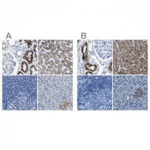 Anti-AMACR antibody produced in rabbit 