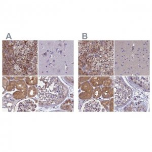 Anti-AMDHD2 antibody produced in rabbit 