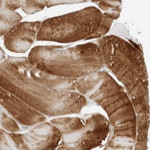 Anti-AMPD1 antibody produced in rabbit 