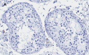 Anti-Androgen Receptor Antibody, clone 3K11 , ZooMAb Rabbit Monoclonal 